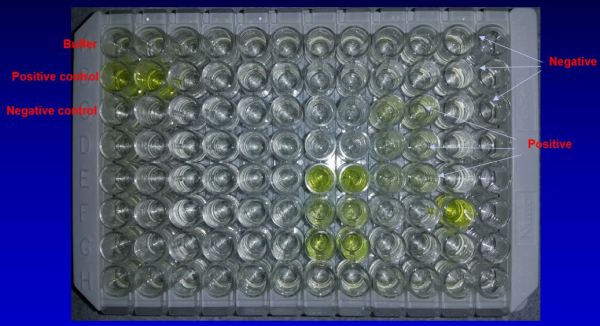ELISA plate with yellow-colored and colorless wells