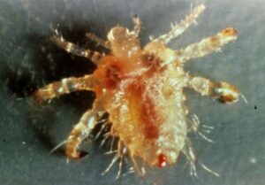 close up of adult pubic louse