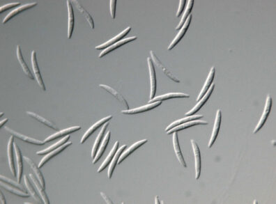 close up view of Anthracnose pathogen