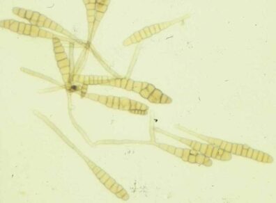 spores of Alternaria brassicae