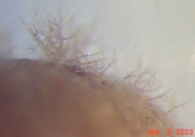 chains of spores of Alternaria brassicicola growing from an infected cabbage seed.