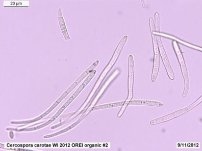 cercospora carotae under microscope-1