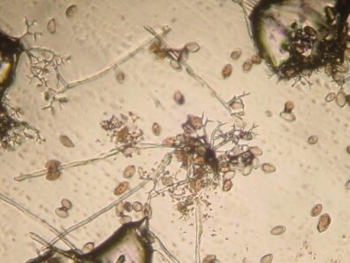 Microscopic photo of downy mildew sporangia-1