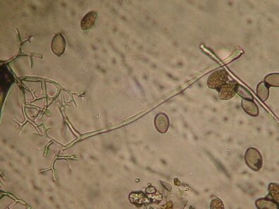 Microscopic photo of downy mildew sporangia-2