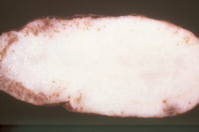 root knot on potato-2