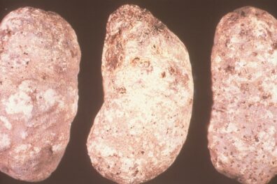 root knot on potato-1