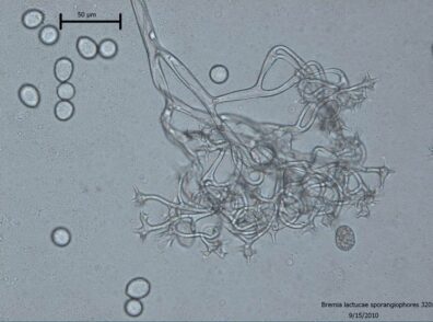Sporangiophores and sporangia of Bremia lactucae