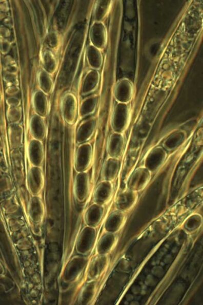 Sclerotinia sclerotiorum pathogen-1
