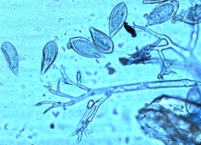 Microscope image of downy mildew pathogen, Peronospora destructor