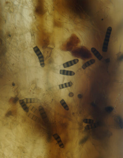pea-thielaviopsis-root-rot-4