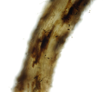 pea-thielaviopsis-root-rot-6