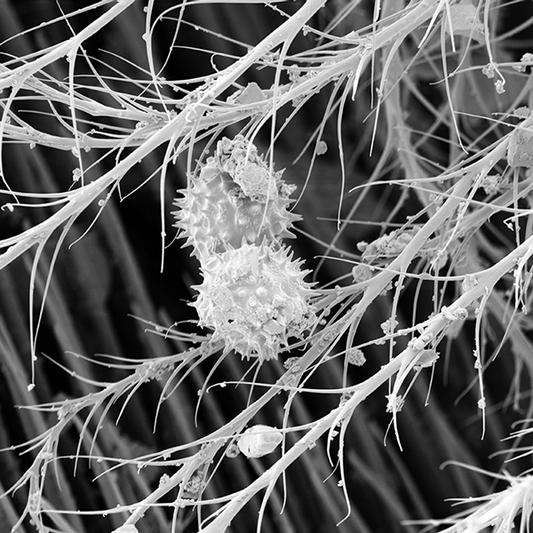 A scanning electron microscope image of pollen grains adhering to the branched hairs of a honey bee.