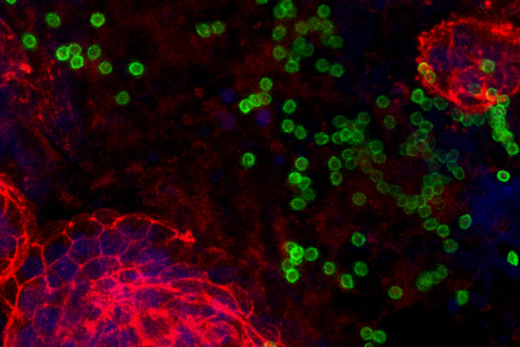 microscope view off cells in green and red
