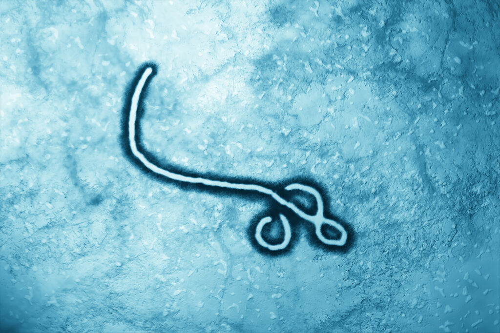 A microscopic image of an Ebola virus.