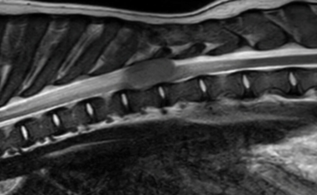 An MRI scan of a dog's spine showing a dark, oval-shaped tumor in the center of the spinal canal.
