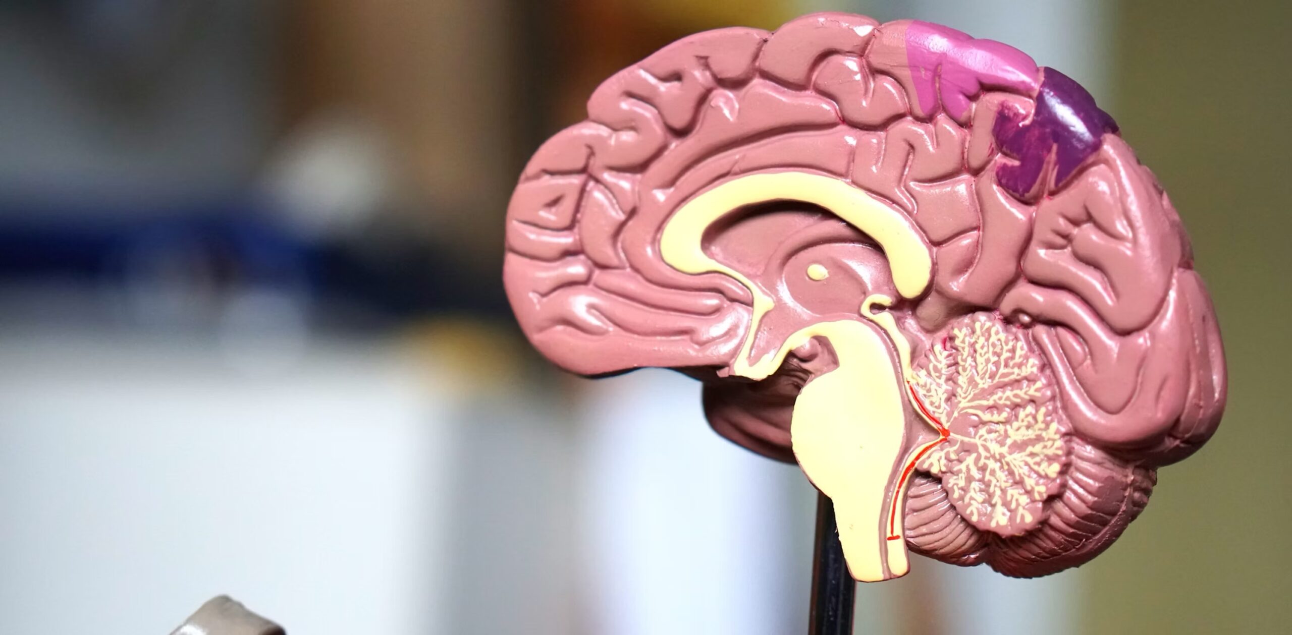A model of a human brain.
