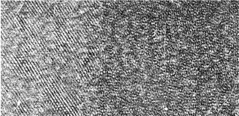 TEM micrograph showing the amorphous atomic structure of BMG versus crystalline atomic structure of a typical metal.