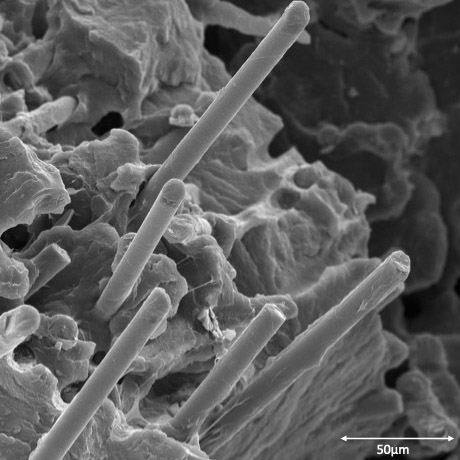 A scanned image from an electron microscope.