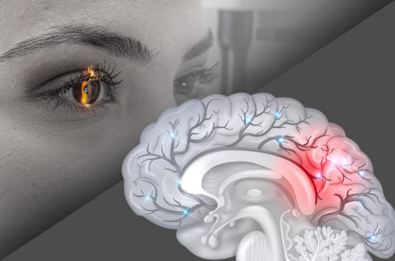 Composite featuring the closeup of a patient's eye during an eye exam and an illustration of a human brain.