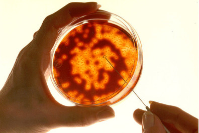 Petri dish