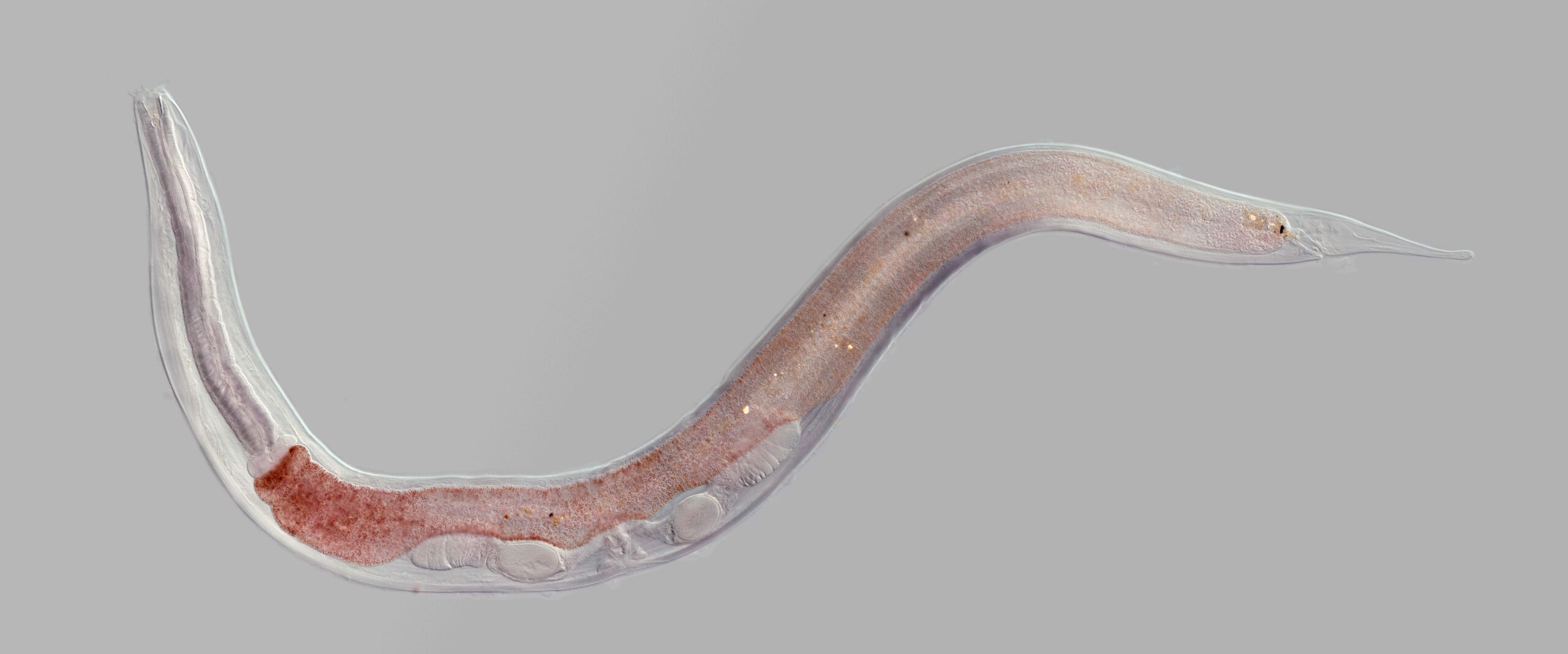 Nematode roundworm.