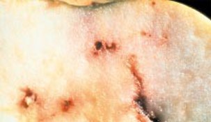Cross-section of an apple with long brown spots.