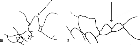 Profile of abdominal pedicel