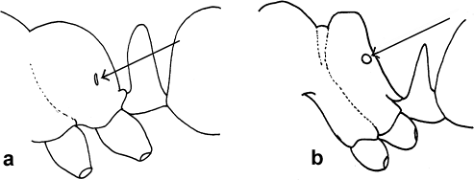 Profile of epinotum and pedicel