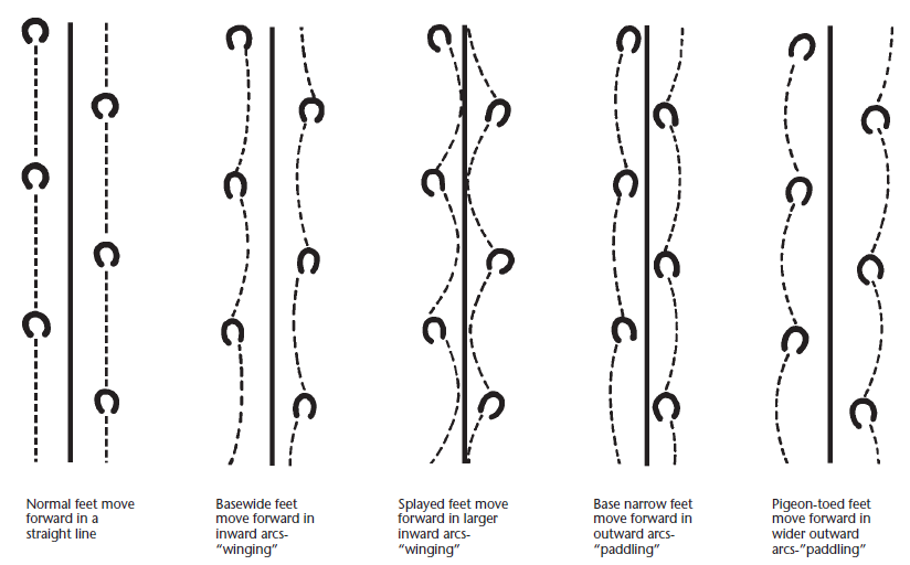 Diagram comparing five horse foot movement patterns: normal, basewide, splayed, base narrow, and pigeon-toed.