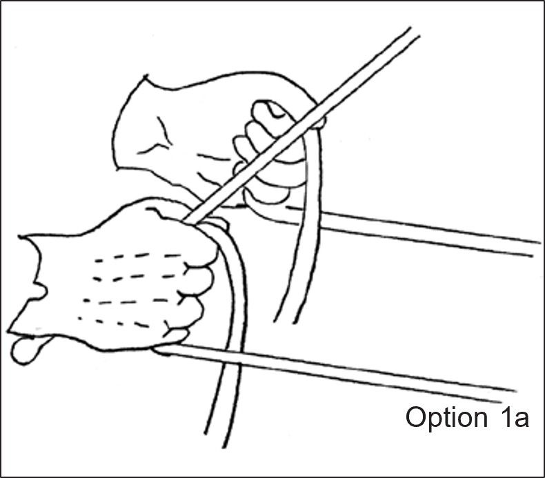 A hand diagram labeled Option 1a, demonstrating an accepted method for gripping and managing driving reins.