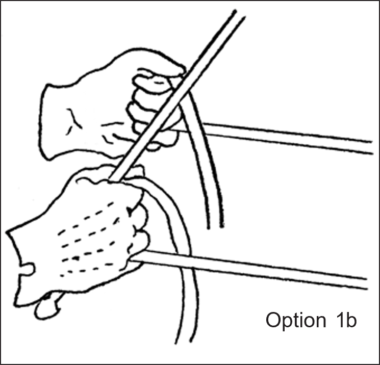 A hand diagram labeled Option 1b, demonstrating an accepted method for gripping and managing driving reins.