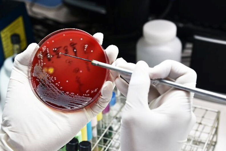 Researcher, wearing white gloves, holding petri dish and using a tool to capture a sample.