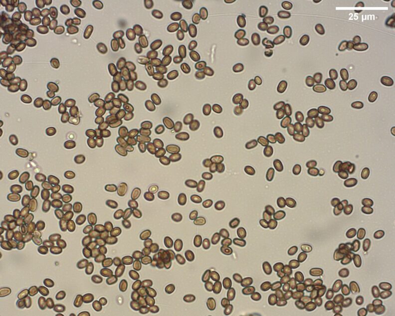 Microscopic view of oval spores of Cryptostroma corticale