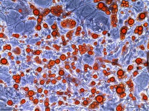 photo of stained cells from a microscope view