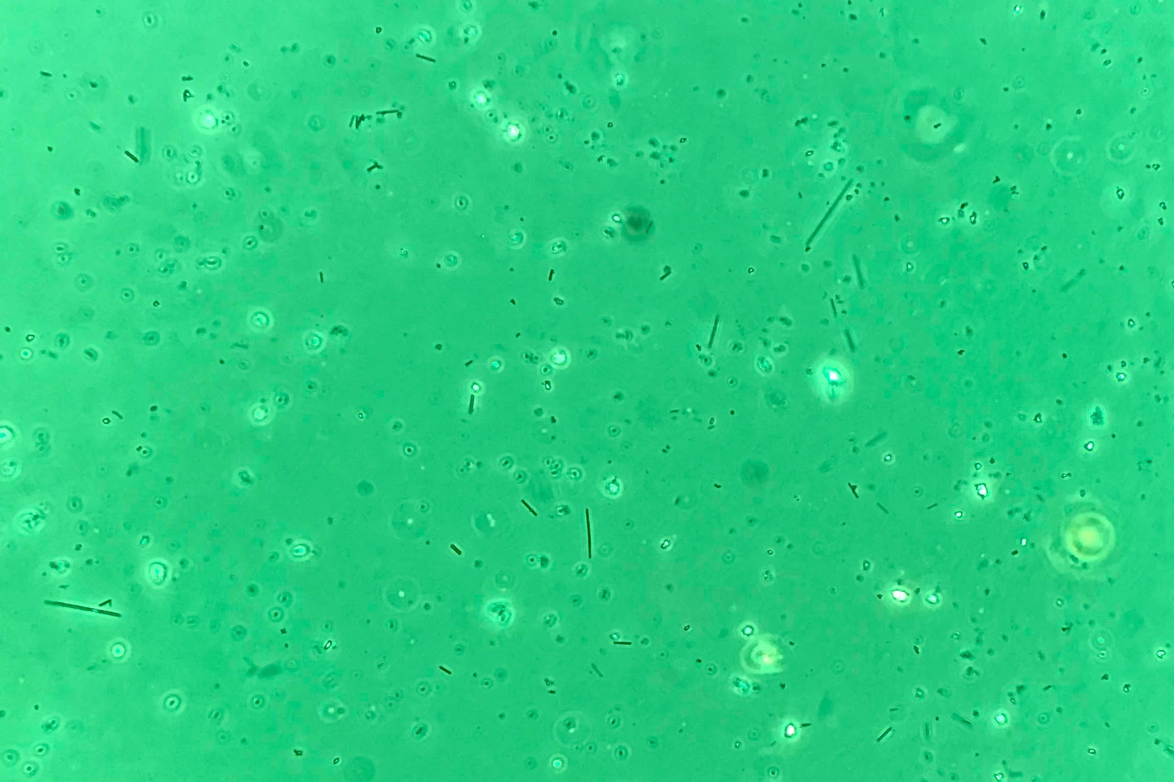 View of asbestos under a microscope