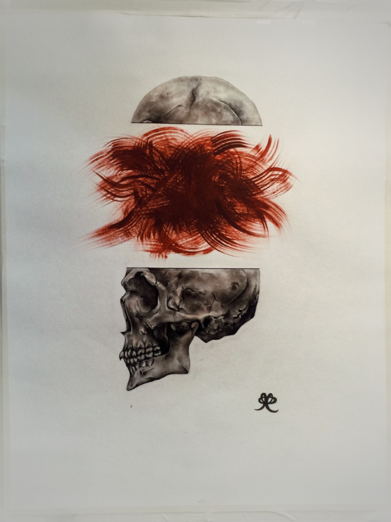 migraine by Paige Parker