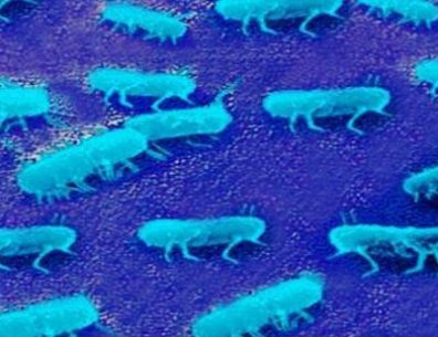 Salmonella under microscope