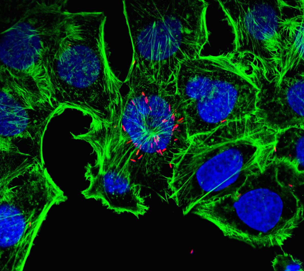 Microscopic photography of campylobacter jejuni