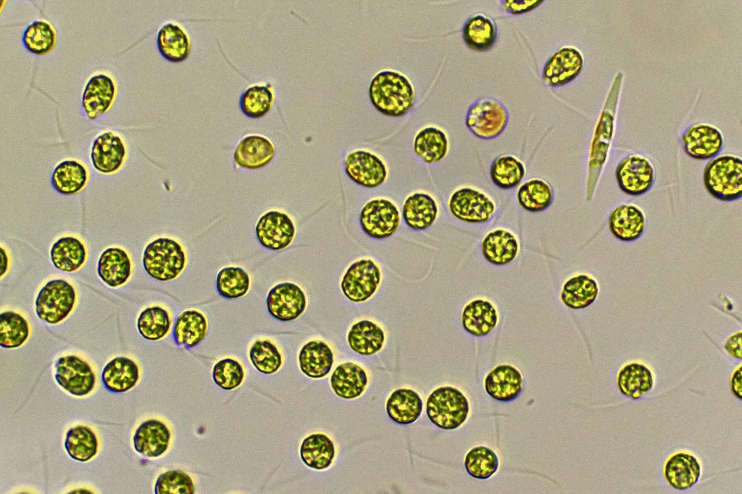 Microscopy image of mixed algal culture