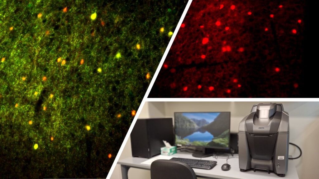 Images were captured using a confocal microscope