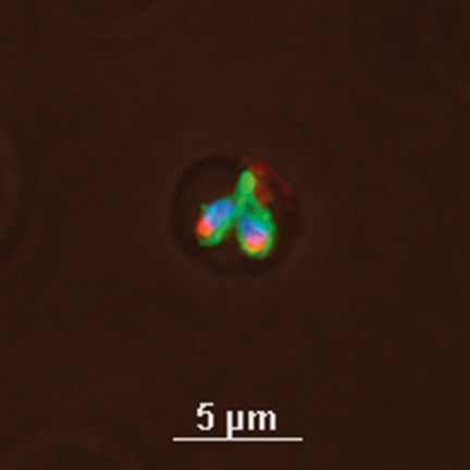 Babesia bovis is a protozoan blood parasite causing babesiosis, a severe anemia that often settles in capillaries in the brain. Found in tropical and subtropical regions, it was common in Texas until the 1940s, when tick-control efforts and a cooling trend drove the ticks south of the border. Rising temperatures may allow the ticks, and Babesia, to return to the United States. Photomicrograph courtesy Guy Palmer and the WSU Franceschi Microscopy and Imaging Center.