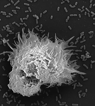 Listeria monocytogenes