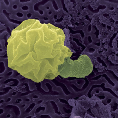 Electron microscope image of Bsal zoospore