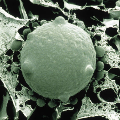 Electron microscope image of Bd zoospore