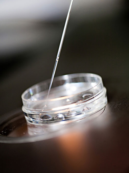 Petri dish and pipette for fertility treatment