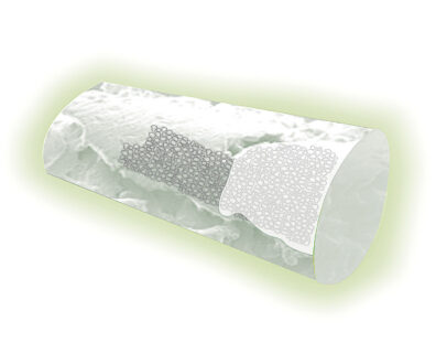 Illustration of a bone showing porous titanium and nanotubes to promote bone growth