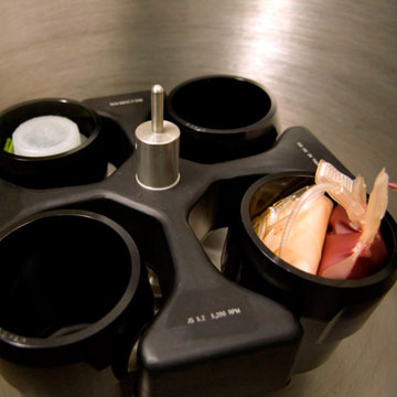 The blood is placed into a centrifuge where the plasma and platelets are separated out