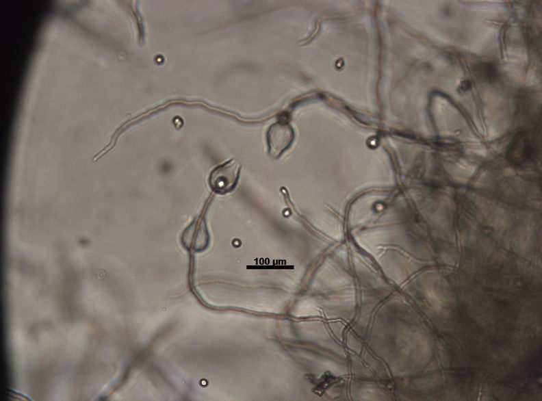 Empty sporangia of a Phytophthora species with a line showing the scale at 100µm