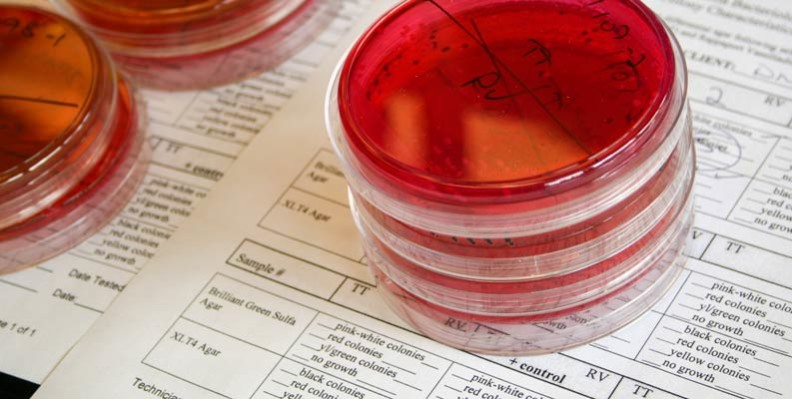 Stacks of red petri dishes sit on top of testing paperwork.