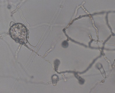 Saprolegnia oogonium being parasitized by Pythium